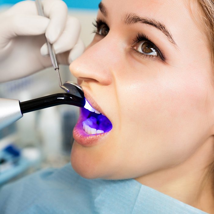 Dentist applying UV light to woman’s treatment