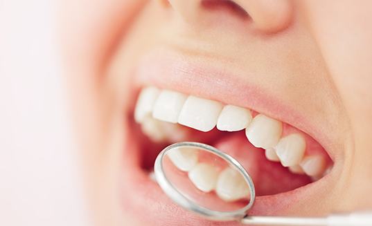 Closeup of someone smiling with mirror reflecting 3 teeth