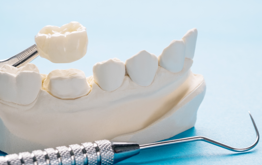 Model of a jaw with a dental crown and dental tools in the forefront