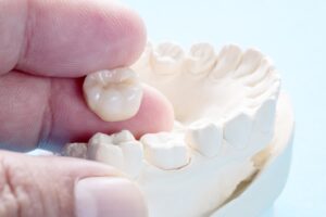 hand holding a dental crown and mouth mold